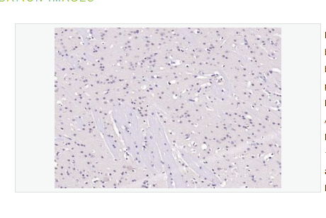 Anti-phospho-AKT  antibody-磷酸化蛋白激酶B单克隆抗体