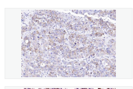 Anti-Collagen II antibody-Ⅱ型胶原α1蛋白/软骨钙素单克隆抗体