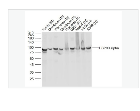 Anti-HSP90 alpha antibody-热休克蛋白90α单克隆抗体