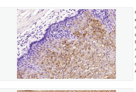 Anti-Cytokeratin 2e  antibody-细胞角蛋白2e重组兔单克隆抗体