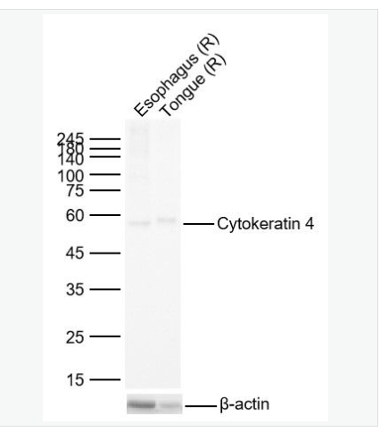 Anti-Cytokeratin 4 antibody-细胞角蛋白4重组兔单克隆抗体