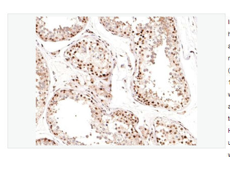 Anti-phospho-Cyclin E1antibody-磷酸化周期素E1重组兔单克隆抗体
