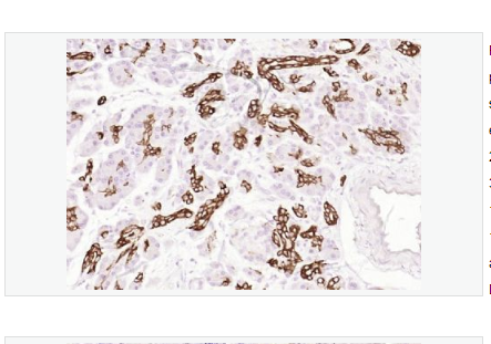 Anti-Cytokeratin 19  antibody-人细胞角蛋白19单克隆抗体