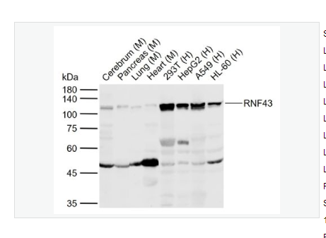 Anti-RNF43 antibody-环指蛋白43抗体
