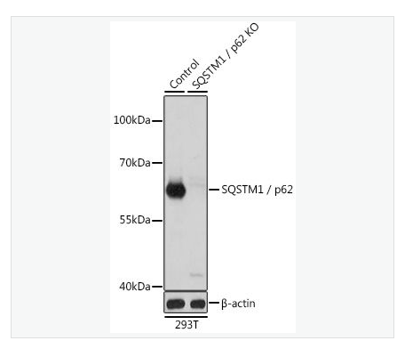 Anti-SQSTM1/p62  antibody-泛素结合蛋白P62抗体