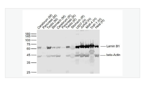 Anti-Lamin B1   antibody-核纤层蛋白B抗体(细胞核膜标志物)
