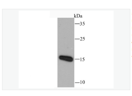 Anti-RANTES  antibody-T细胞特异性趋化因子重组兔单克隆抗体