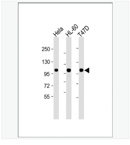 Anti-EZH2 antibody-抑癌蛋白EZH2单克隆抗体