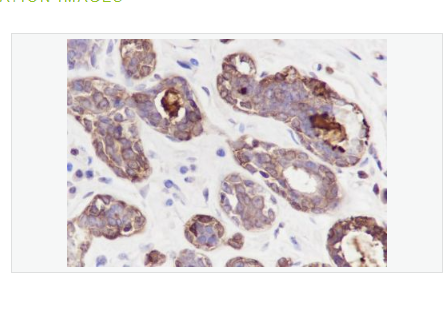Anti-GCDGP15  antibody-囊性组织液体蛋白15重组兔单克隆抗体