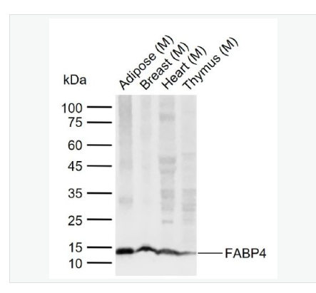 Anti-FABP4 antibody-脂肪细胞型脂肪酸结合蛋白4重组兔单克隆抗体