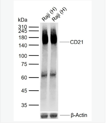 Anti-CD21 antibody-CR2重组兔单克隆抗体