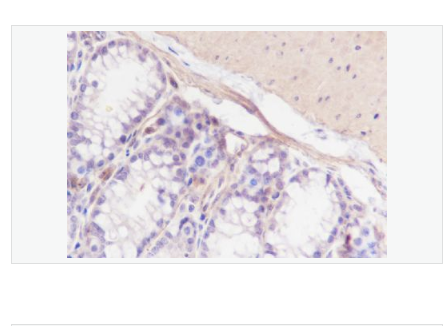 Anti-Calponin-1 antibody-钙调节蛋白-1重组兔单克隆抗体