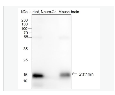 Anti-STMN1 antibody-白血病相关蛋白18/癌蛋白18重组兔单克隆抗体