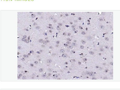 Anti-AEBP1 antibody-脂肪细胞增强结合蛋白1抗体