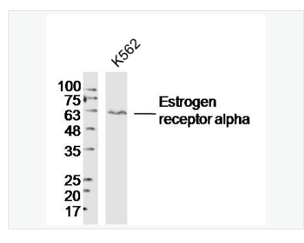 Anti-Estrogen receptor alpha  antibody-雌激素受体α抗体