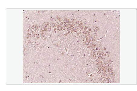 Anti-Bid antibody-BH3结构域凋亡诱导蛋白抗体