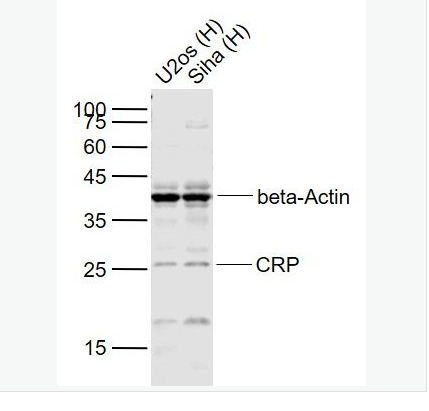 Anti-CRF antibody-促肾上腺皮质激素释放因子/促肾上皮质激素释放激素抗体