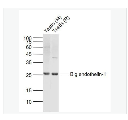Anti-Big endothelin-1 antibody-内皮素-1抗体