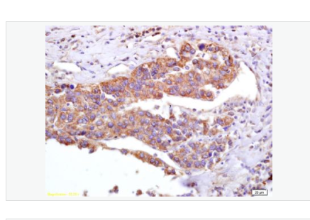 Anti-GAPDH antibody-3-磷酸甘油醛脱氢酶