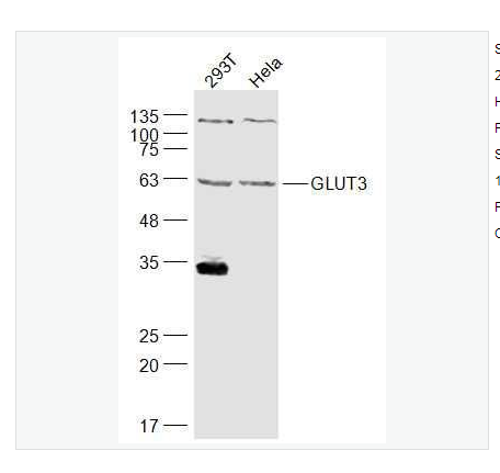 Anti-GLUT3  antibody-葡萄糖转运蛋白3抗体