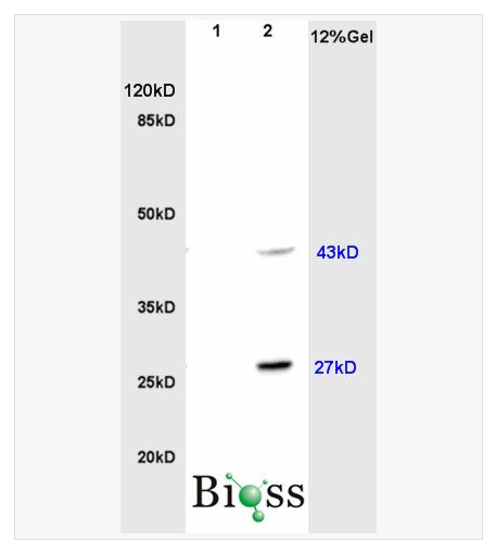 Anti-HOXc8 antibody-HOXc8抗体