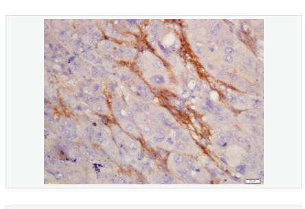 Anti-MMP9 antibody-基质金属蛋白酶-9抗体