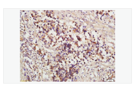 Anti-MRP1/ABCC1 antibody-多药耐药相关蛋白1抗体