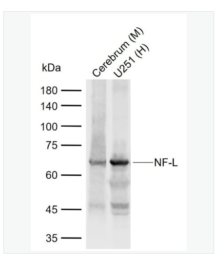 Anti-NF-L  antibody-低分子量神经丝蛋白抗体