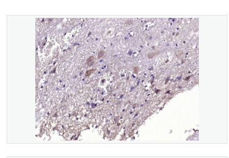 Anti-NKB  antibody-神经激肽B抗体