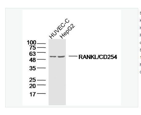 Anti-RANKL/CD254 antibody-骨保护蛋白配体/破骨细胞分化因子抗体
