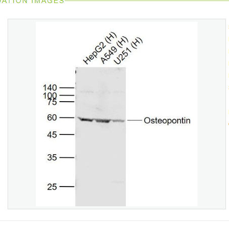 Anti-Osteopontin  antibody-骨桥蛋白/分泌型磷蛋白1抗体