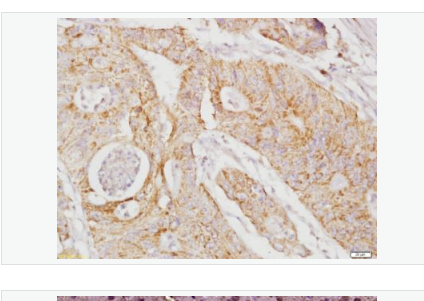 Anti-RhoA antibody-RhoA抗体