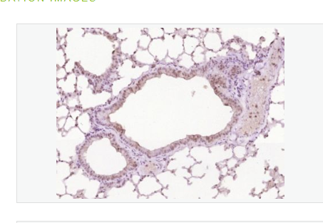 Anti-STAT3 antibody-信号转导和转录激活因子3抗体