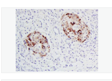 Anti-SNAI1 antibody-Snail蛋白抗体