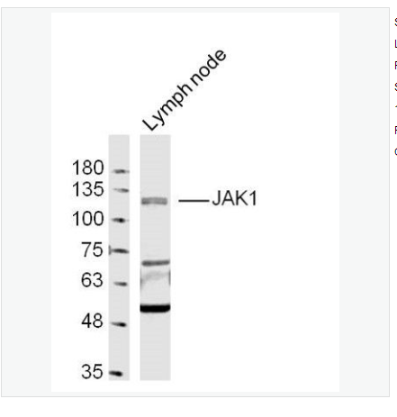 Anti-JAK1 antibody-蛋白质酪氨酸激酶JAK-1抗体