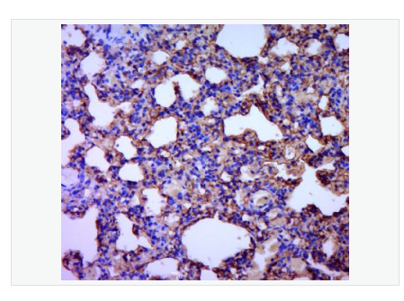 Anti-Aquaporin 5 antibody-水通道蛋白5抗体