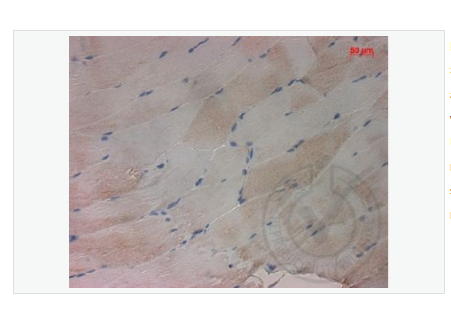 Anti-PALB2 antibody-乳腺癌易感基因相关蛋白2