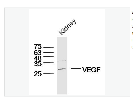 Anti-VEGFA  antibody-血管内皮生长因子抗体