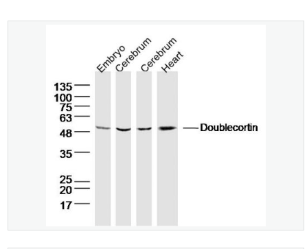 Anti-Doublecortin antibody-双皮质素抗体