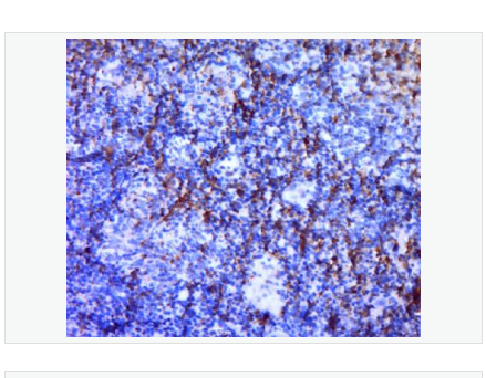 Anti-TERT antibody-端粒酶逆转录酶抗体