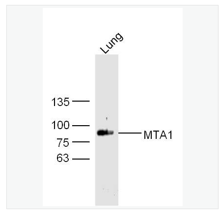 Anti-MTA1 antibody-肿瘤转移相关蛋白1抗体