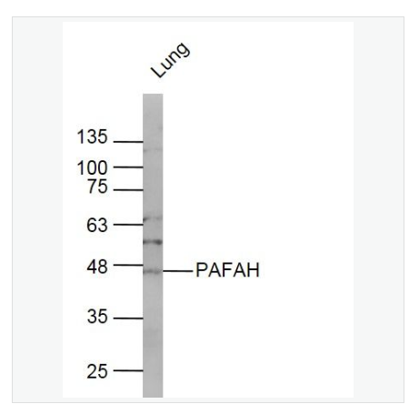 Anti-PLA2G7 antibody-脂蛋白磷脂酶A2抗体
