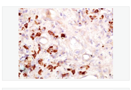 Anti-FUT4 antibody-α-(1,3)-岩藻糖基转移酶 4抗体