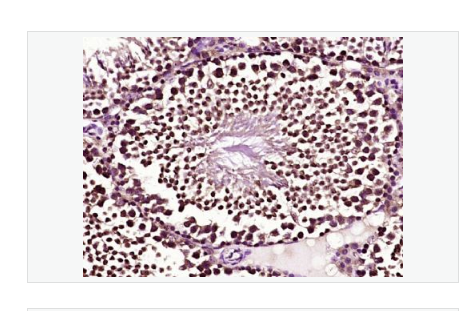 Anti-BCL2L1 antibody-Bcl-xL蛋白抗体
