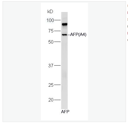 Anti-AFP(A2 antibody-甲胎蛋白单克隆抗体（包被）