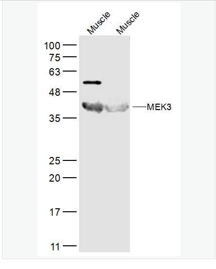 Anti-MEK3  antibody-丝裂原活化蛋白激酶MKK3抗体