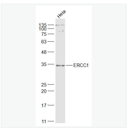 Anti-ERCC1antibody-DNA切除修复蛋白1抗体
