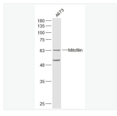 Anti-CPT1A antibody-肉毒碱棕榈酰基转移酶1A抗体