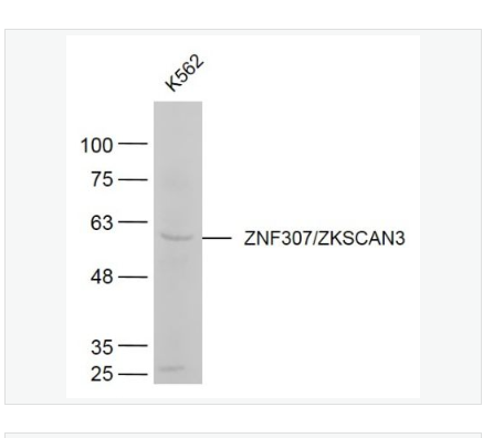 Anti-ZNF307/ZKSCAN3 antibody-锌指蛋白307抗体
