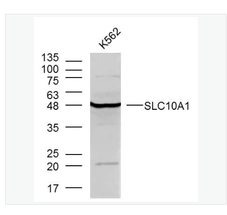 Anti-SLC10A1 antibody-钠离子/牛磺胆酸共转运蛋白抗体